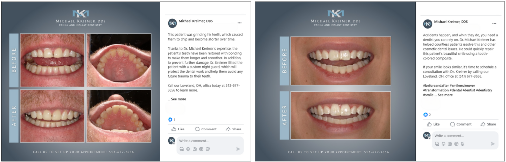 Dental Marketing Company patient approach for social media for Dr. Kreimer